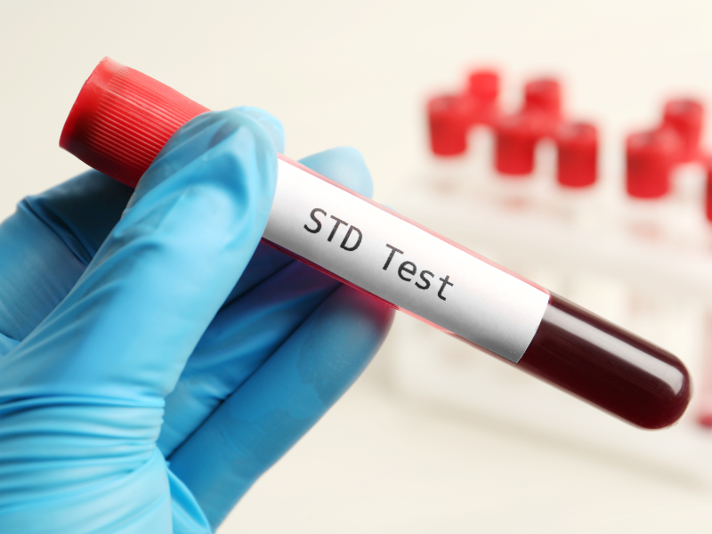 Healthcare provider offering confidential STD testing, diagnosis, and treatment in a private clinical setting.